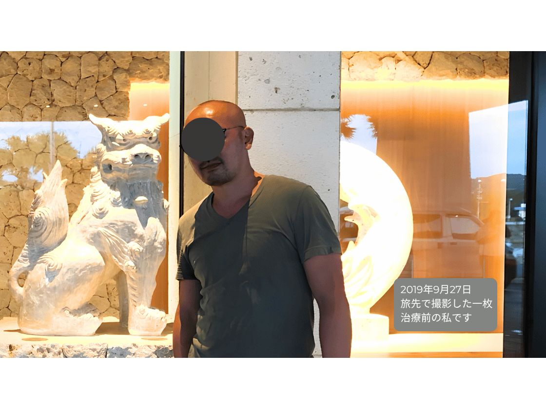 第4章：半信半疑で始めたAGA治療